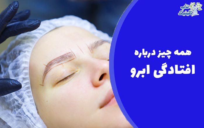 Eyebrow drooping treatment methods-image