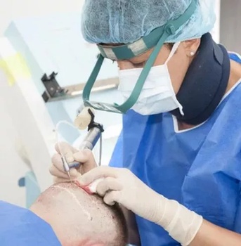  الصوره زراعة الشعر FIT